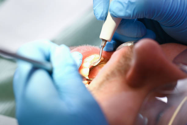 Best Emergency TMJ Treatment in Wendell, NC