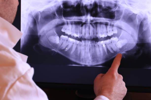 Best Emergency Gum Treatment in Wendell, NC