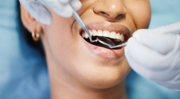 Best Emergency Dental Care for Broken or Chipped Teeth in Wendell, NC