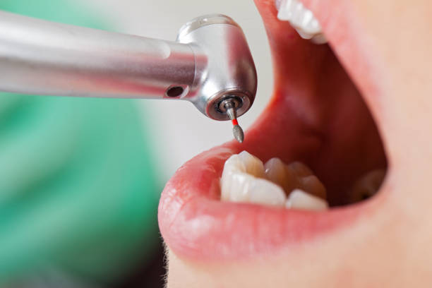 Best Emergency Denture Repair in Wendell, NC